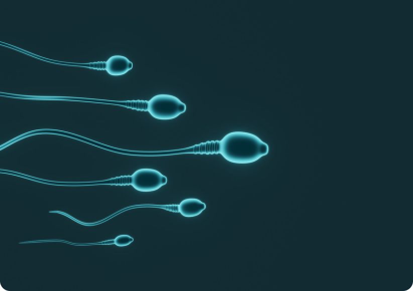 Asthenozoospermia 