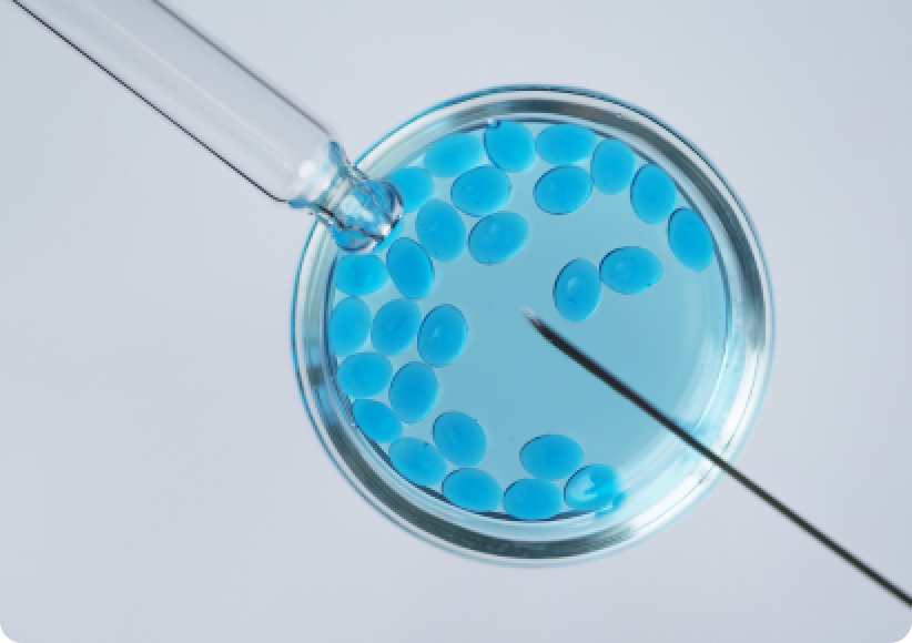 Conventional IVF
